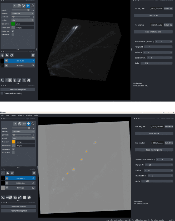 Comparison between ground-truth annotations and the 3D volume: visible structures don’t always match the reference points.
