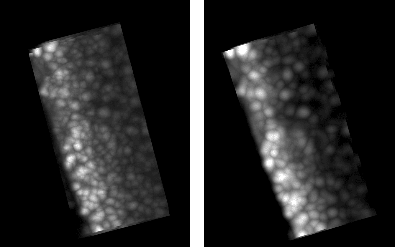 Before/after comparison of preprocessing on a sub-volume: noise reduction and improved contrast.